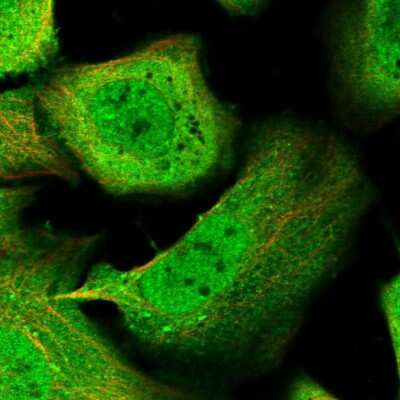 Immunocytochemistry/ Immunofluorescence: KLHL7 Antibody [NBP1-82871]