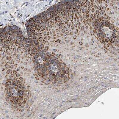 Immunohistochemistry-Paraffin: KLHL7 Antibody [NBP1-81349]