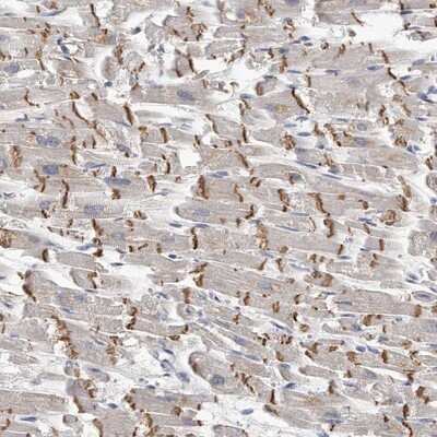 Immunohistochemistry-Paraffin: KLHL7 Antibody [NBP1-82871]