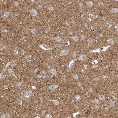 Immunohistochemistry-Paraffin: KLHL7 Antibody [NBP1-82871]
