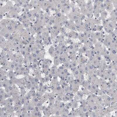 Immunohistochemistry-Paraffin: KLHL7 Antibody [NBP1-82871]