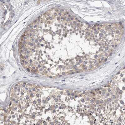 Immunohistochemistry-Paraffin: KLHL7 Antibody [NBP1-82871]