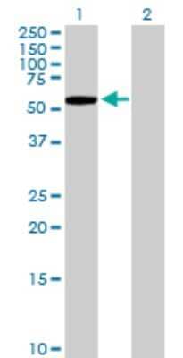 Western Blot: KLHL7 Antibody [H00055975-B01P]