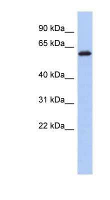 Western Blot: KLHL7 Antibody [NBP1-55462]