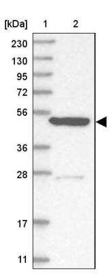 Western Blot: KLHL7 Antibody [NBP1-82871]