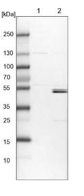 Western Blot: KLHL7 Antibody [NBP1-82871]