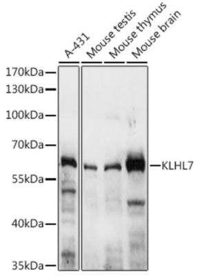 Western Blot: KLHL7 AntibodyAzide and BSA Free [NBP3-03938]