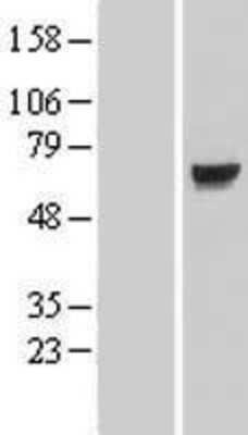 Western Blot: KLHL7 Overexpression Lysate [NBL1-12342]