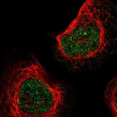 Immunocytochemistry/ Immunofluorescence: KLHL8 Antibody [NBP2-47406]