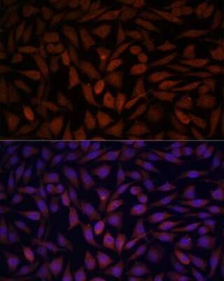 Immunocytochemistry/ Immunofluorescence: KLHL8 Antibody - Azide and BSA Free [NBP3-04914]