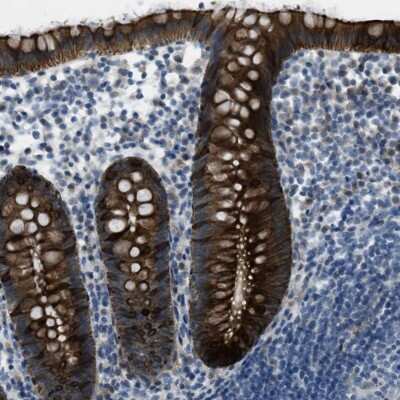 Immunohistochemistry-Paraffin: KLHL8 Antibody [NBP2-47406]