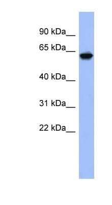 Western Blot: KLHL8 Antibody [NBP1-80346]