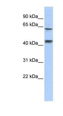 Western Blot: KLHL8 Antibody [NBP1-80347]