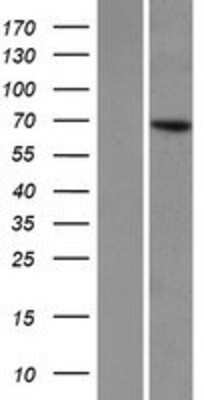 Western Blot: KLHL8 Overexpression Lysate [NBP2-06587]