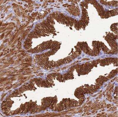 Immunohistochemistry-Paraffin: KLHL9 Antibody [NBP2-54727]