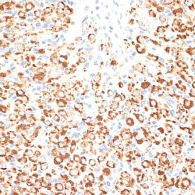 Immunohistochemistry-Paraffin: KLHL9 Antibody - BSA Free [NBP3-04398]