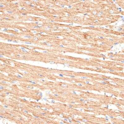 Immunohistochemistry-Paraffin: KLHL9 Antibody - BSA Free [NBP3-04398]