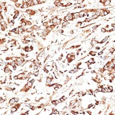 Immunohistochemistry-Paraffin: KLHL9 Antibody - BSA Free [NBP3-04398]