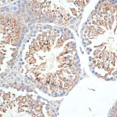 Immunohistochemistry-Paraffin: KLHL9 Antibody - BSA Free [NBP3-04398]