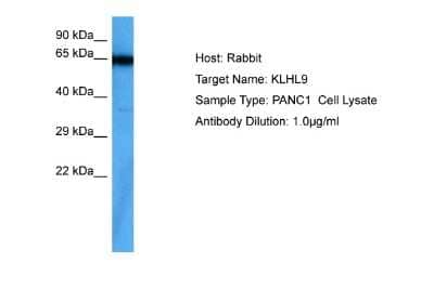 Western Blot: KLHL9 Antibody [NBP2-87700]