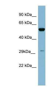 Western Blot: Kallikrein 10 Antibody [NBP1-58249]