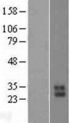 Western Blot: Kallikrein 10 Overexpression Lysate [NBP2-11450]