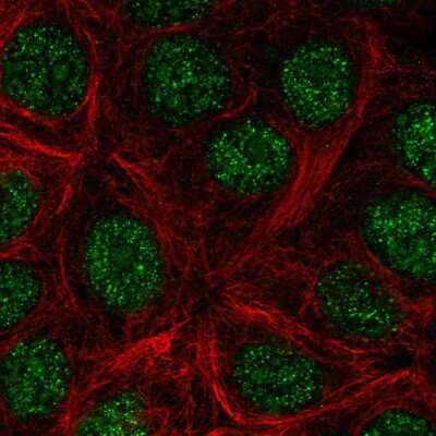 Immunocytochemistry/ Immunofluorescence: KLLN Antibody [NBP2-57404]