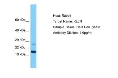 Western Blot: KLLN Antibody [NBP2-83124]