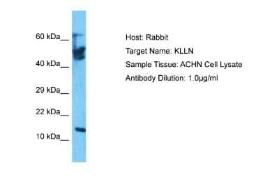 Western Blot: KLLN Antibody [NBP2-83125]