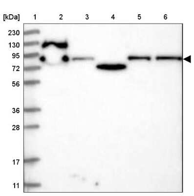 Western Blot: KLRAQ1 Antibody [NBP1-86582]