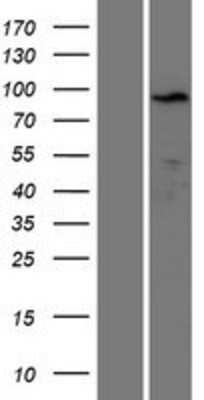 Western Blot: KLRAQ1 Overexpression Lysate [NBP2-05299]