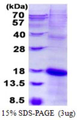 SDS-PAGE: Recombinant Human NKG2C/CD159c/KLRC2 His Protein [NBP2-23170]