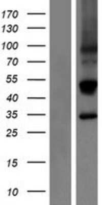 Western Blot: NKG2E/KLRC3 Overexpression Lysate [NBP2-07505]