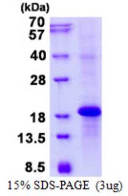 SDS-PAGE: Recombinant Human NKG2E/KLRC3 His Protein [NBP2-23171]