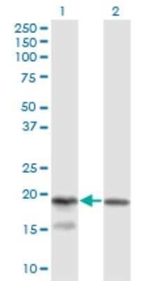 Western Blot: KLRC4 Antibody (1D10) [H00008302-M03]