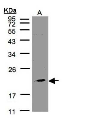 Western Blot: KLRC4 Antibody [NBP1-31161]