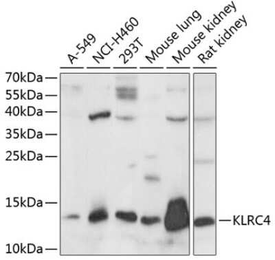 Western Blot: KLRC4 AntibodyAzide and BSA Free [NBP3-04739]