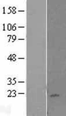 Western Blot: KLRC4 Overexpression Lysate [NBL1-12364]