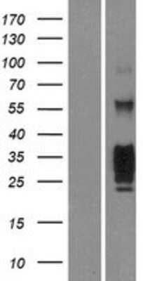 Western Blot: KLRG1 Overexpression Lysate [NBP2-07698]