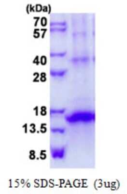 SDS-PAGE: Recombinant Human KLRG1 His Protein [NBP2-23172]