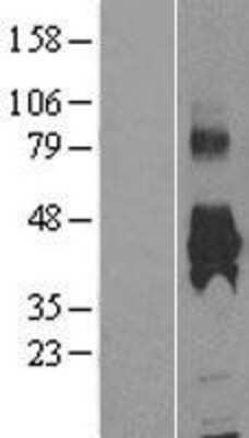 Western Blot: Kynurenine 3-Monooxygenase/KMO Overexpression Lysate [NBP2-04254]