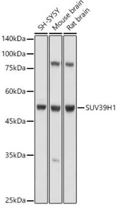 Western Blot: KMT1A/SUV39H1 AntibodyAzide and BSA Free [NBP3-03367]