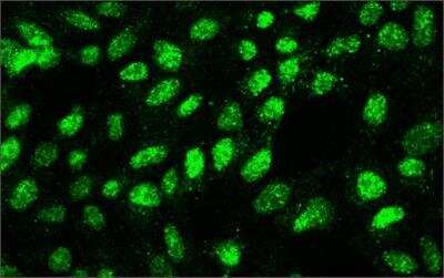 Immunocytochemistry/ Immunofluorescence: KMT1A/SUV39H1 Antibody (44.1) - BSA Free [NB120-12405]