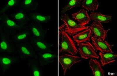 Immunocytochemistry/ Immunofluorescence: KMT1A/SUV39H1 Antibody [NBP2-17086]