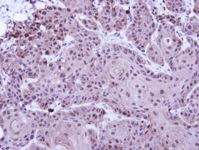 Immunohistochemistry-Paraffin: KMT1A/SUV39H1 Antibody [NBP2-17086]