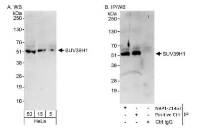 Western Blot: KMT1A/SUV39H1 Antibody [NBP1-21367]