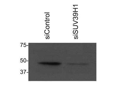 Western Blot: KMT1A/SUV39H1 Antibody [NBP2-17086]
