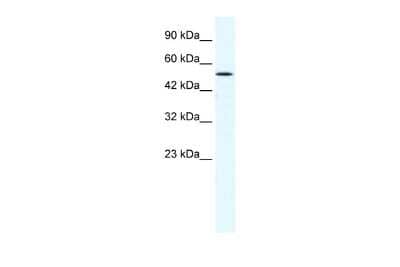 Western Blot: KMT1A/SUV39H1 Antibody [NBP2-82268]