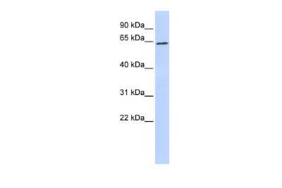 Western Blot: KMT1A/SUV39H1 Antibody [NBP2-82269]