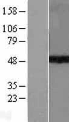 Western Blot: KMT1A/SUV39H1 Overexpression Lysate [NBL1-16625]